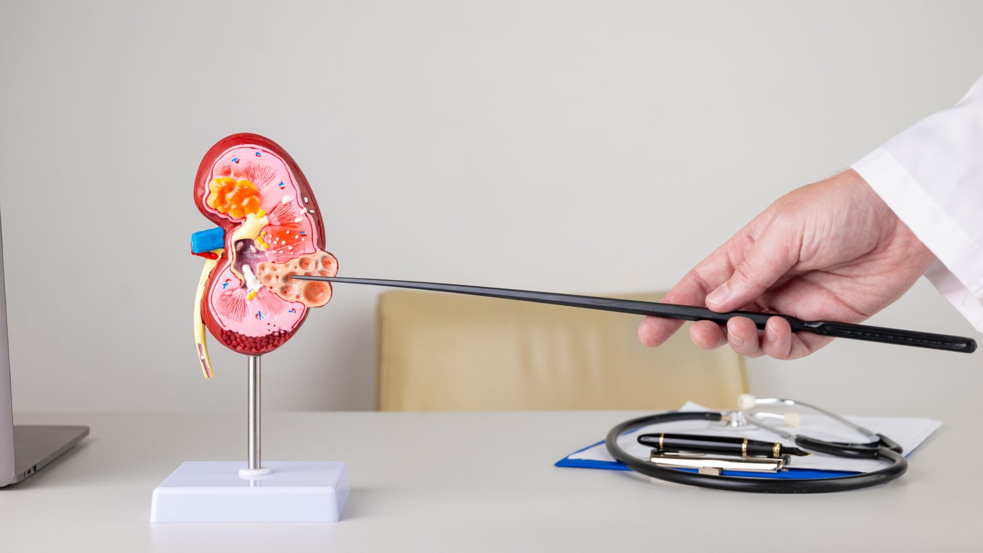 What To Expect When Visiting  a Nephrologist For The First Time